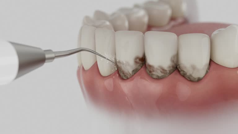 Reliable Dental Implants contractor in Auburn, MI by Smile Center Dentistry